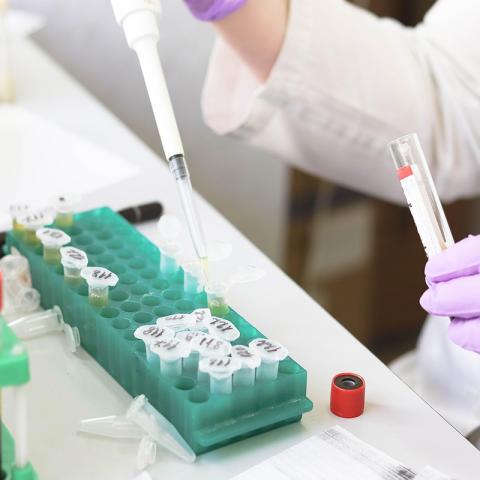 Detección de Ets Parroquia Chiquintad